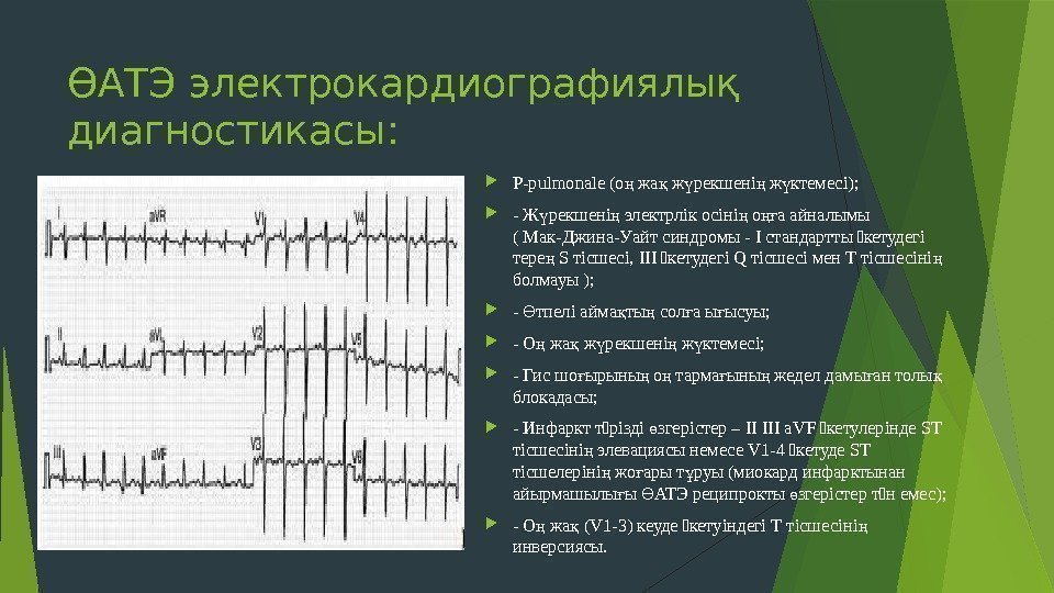 ӨАТЭ электрокардиографиялық диагностикасы:  P-pulmonale (о жа ж рекшені ж ктемесі); ң қ ү