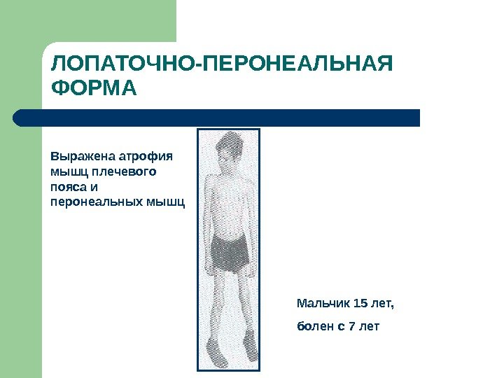 ЛОПАТОЧНО-ПЕРОНЕАЛЬНАЯ ФОРМА  Выражена атрофия мышц плечевого пояса и перонеальных мышц Мальчик 15 лет,