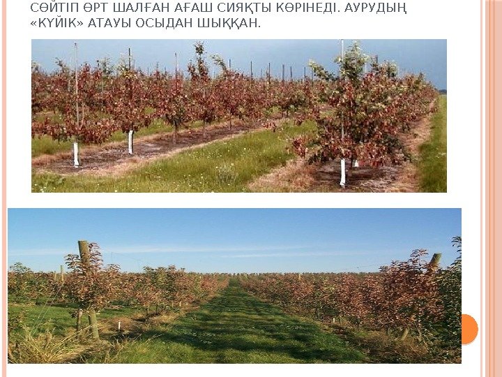 СӨЙТІП ӨРТ ШАЛҒАН АҒАШ СИЯҚТЫ КӨРІНЕДІ. АУРУДЫҢ  «КҮЙІК» АТАУЫ ОСЫДАН ШЫҚҚАН. 