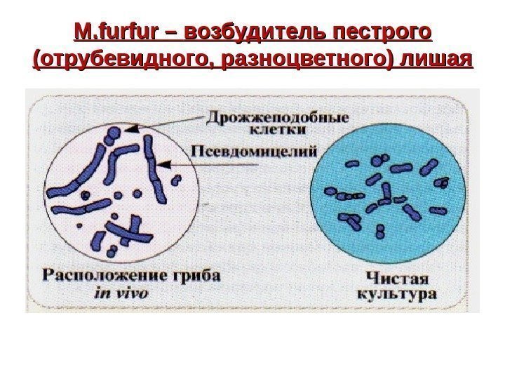   M. furfur – возбудитель пестрого (отрубевидного, разноцветного) лишая 