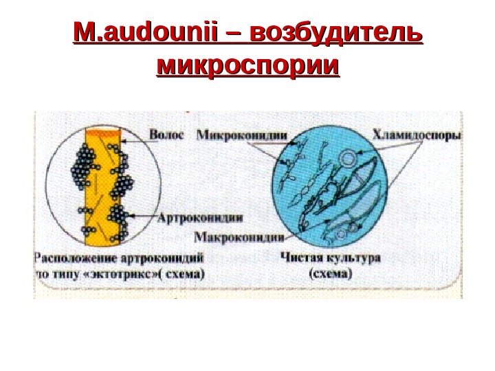   M. audounii – возбудитель микроспории 
