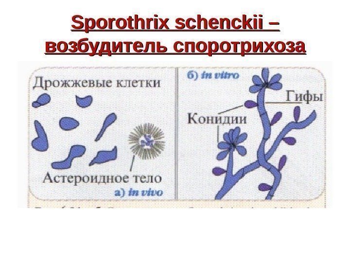   Sporothrix schenckii – возбудитель споротрихоза 