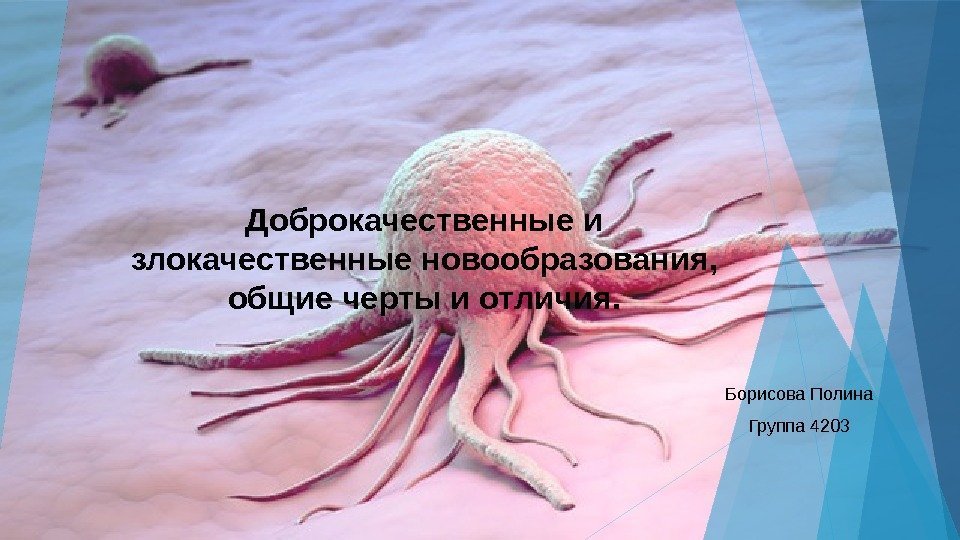 Доброкачественные и злокачественные новообразования,  общие черты и отличия. Борисова Полина Группа 4203 