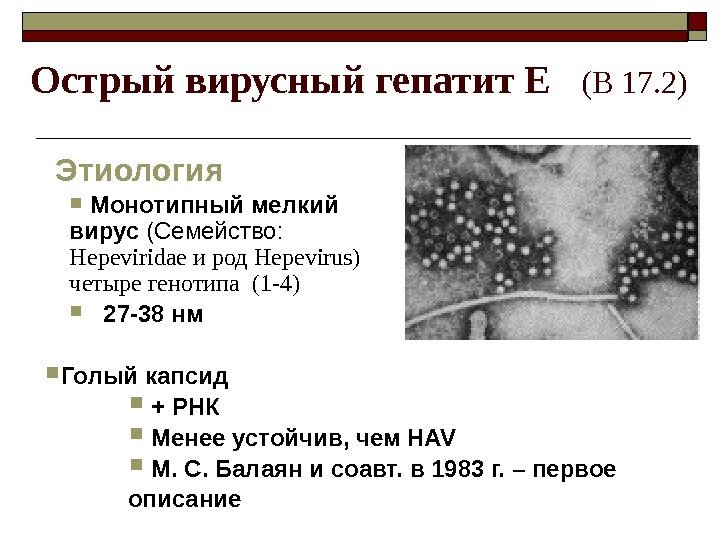 Острый вирусный гепатит Е (В 17. 2) Этиология  Монотипный мелкий вирус (Семейство: 