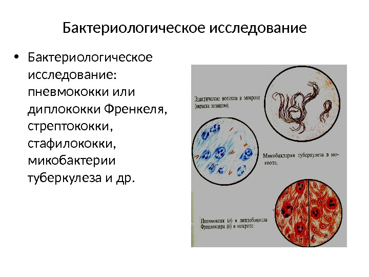 Бактериологическое исследование • Бактериологическое исследование:  пневмококки или диплококки Френкеля,  стрептококки,  стафилококки,