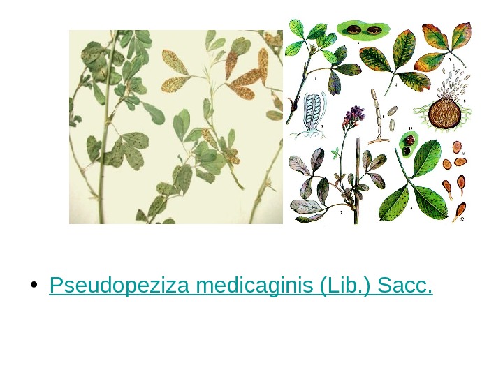   • Pseudopeziza  medicaginis ( Lib. ) Sacc. 