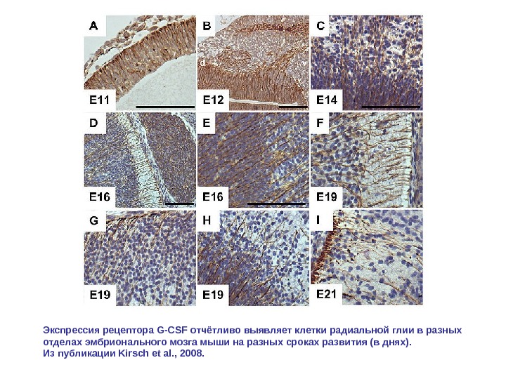 Экспрессия рецептора G-CSF отчётливо выявляет клетки радиальной глии в разных отделах эмбрионального мозга мыши