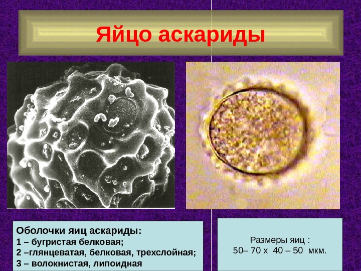 Яйцо аскариды Оболочки яиц аскариды: 1 – бугристая белковая; 2 –глянцеватая, белковая,  трехслойная;