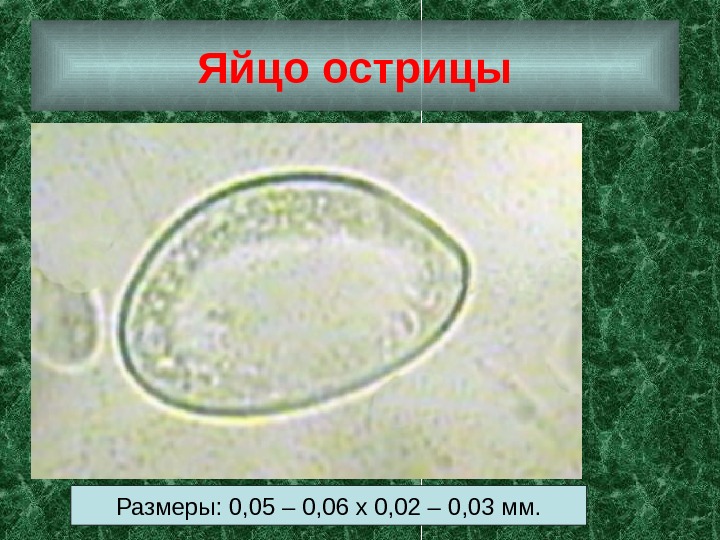 Яйцо острицы Размеры: 0, 05 – 0, 06 х 0, 02 – 0, 03