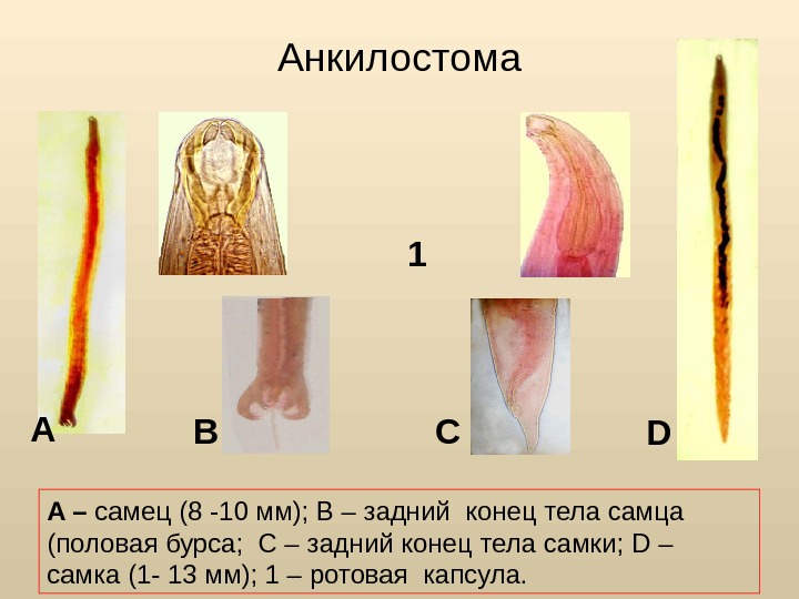 Анкилостома A B DC 1 A – самец (8 -10 мм); В – задний