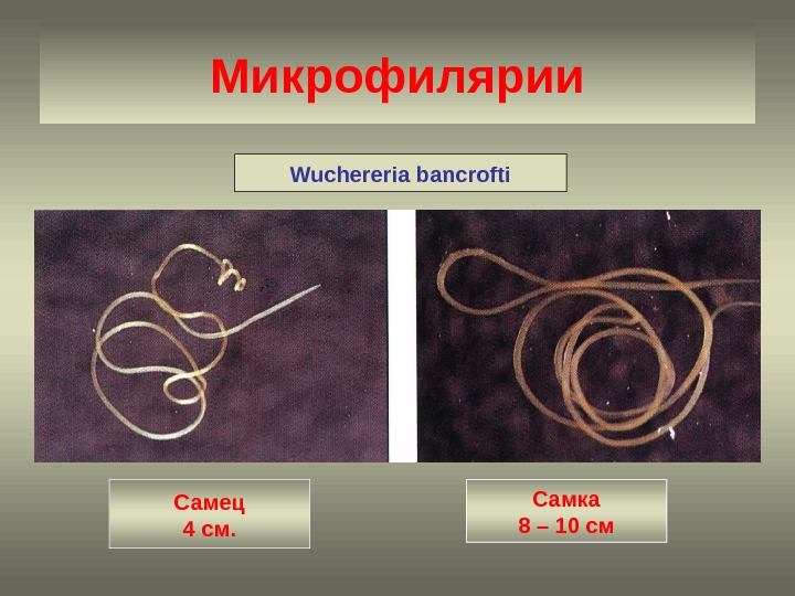 Микрофилярии Wuchereria bancrofti Самец 4 см. Самка 8 – 10 см 