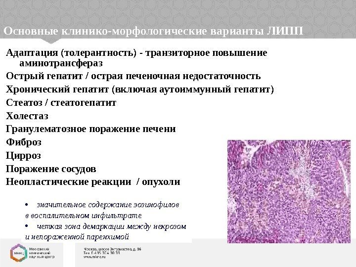 Основные клинико-морфологические варианты ЛИПП Адаптация (толерантность) - транзиторное повышение аминотрансфераз Острый гепатит / острая