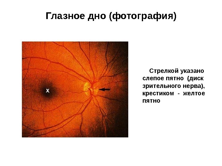 Глазное дно (фотография)  Стрелкой указано слепое пятно (диск зрительного нерва),  крестиком -