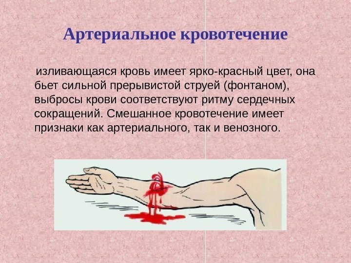 Артериальное кровотечение  изливающаяся кровь имеет ярко-красный цвет, она бьет сильной прерывистой струей (фонтаном),