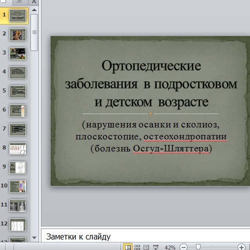 Презентация Ортопедические заболевания у детей