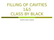 FILLING OF CAVITIES 1&5 CLASS BY BLACK PHANTOM