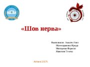«Шов нерва» Астана 2017 г. Выполнили: Аккаев